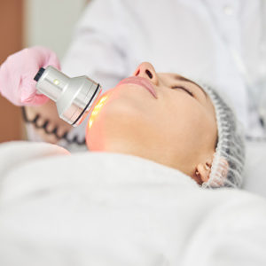 IPL skin Laser treatment in Watergardens 